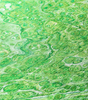 78096624